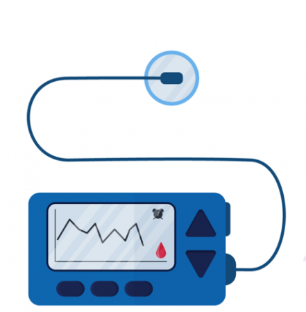 Insulin Pump